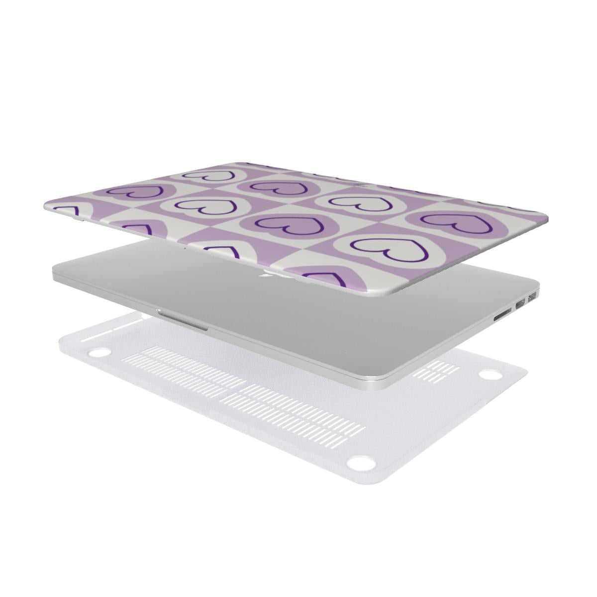 Sweetheart Glow MacBook Case