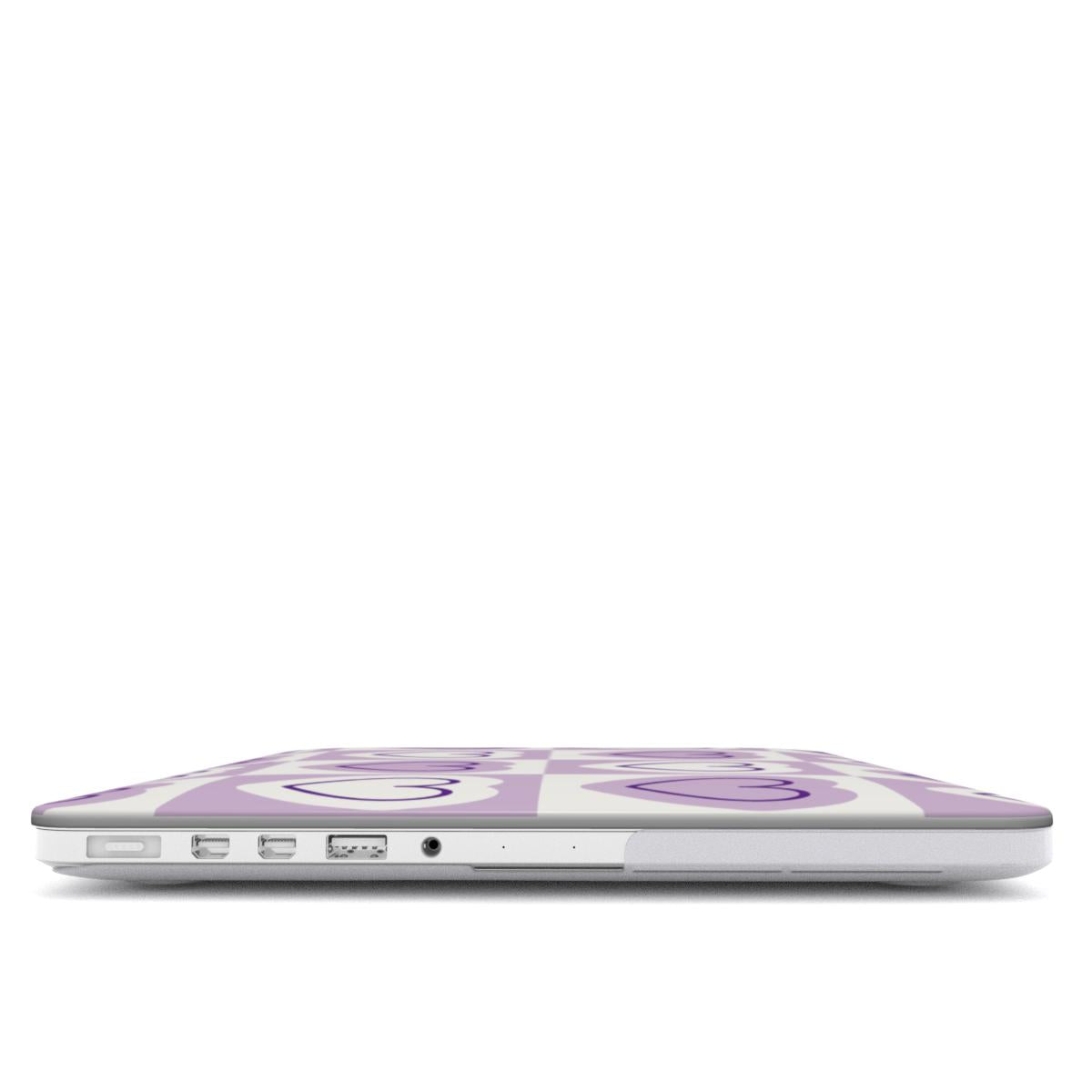 Sweetheart Glow MacBook Case