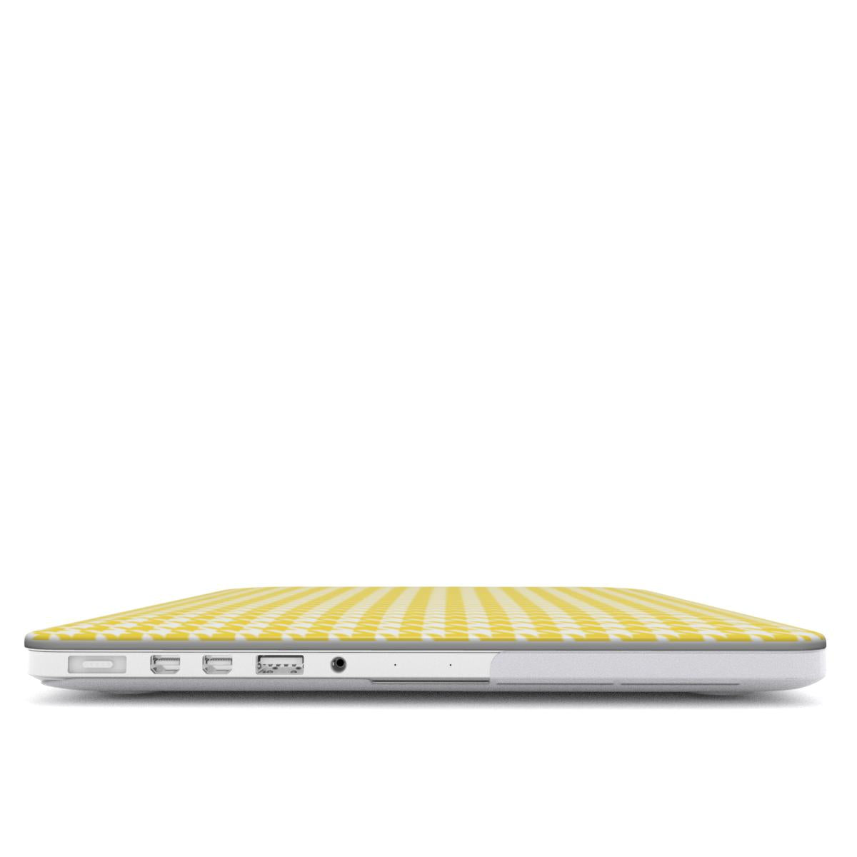Sunny hny MacBook Case